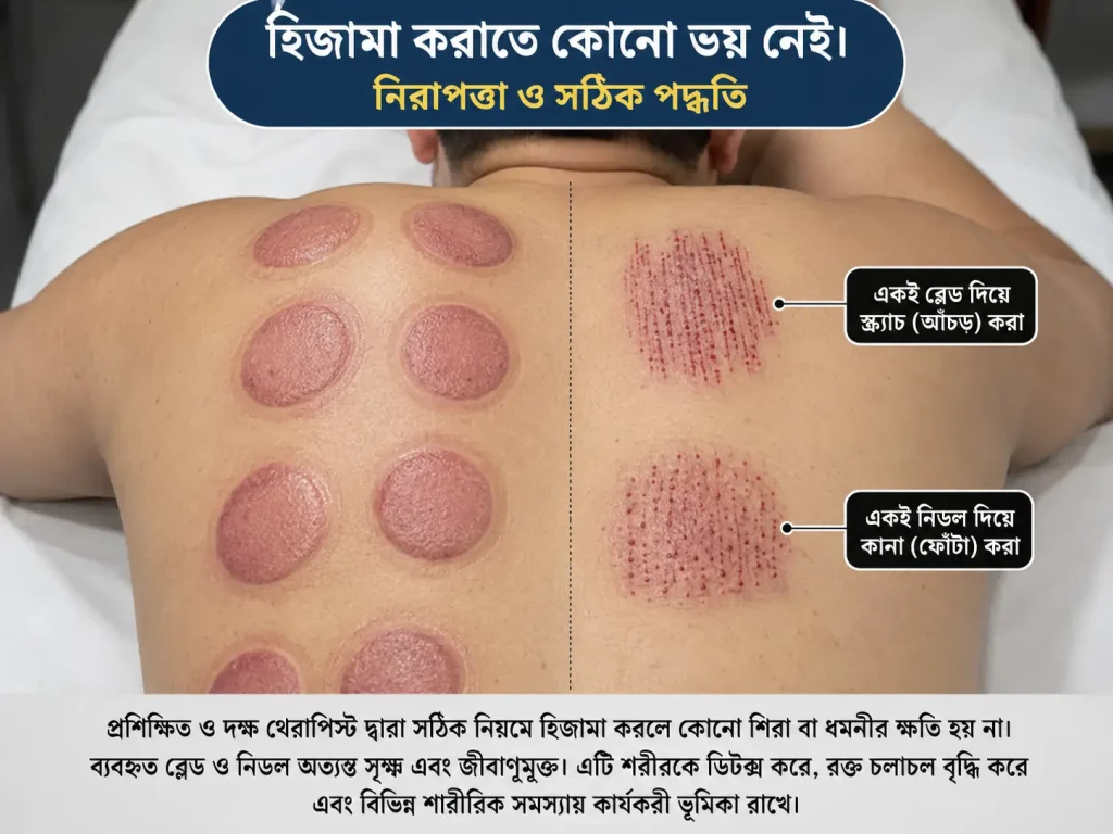 don't fear about hijama